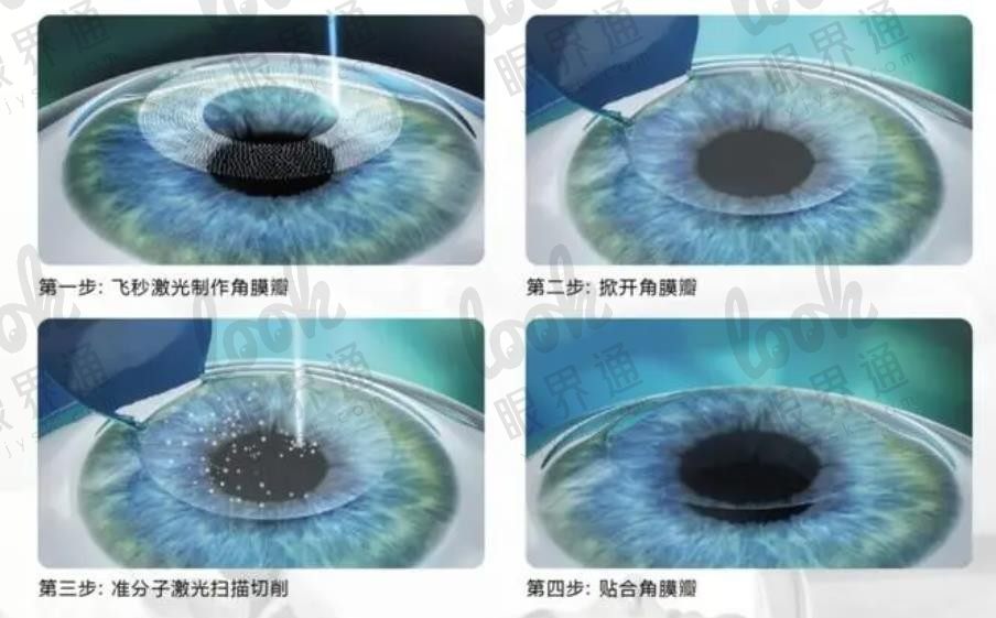 沈阳普瑞眼科医院医生介绍：医院简介、口碑评价、正规性、详细地址、挂号流程、医生团队介绍齐全呈现