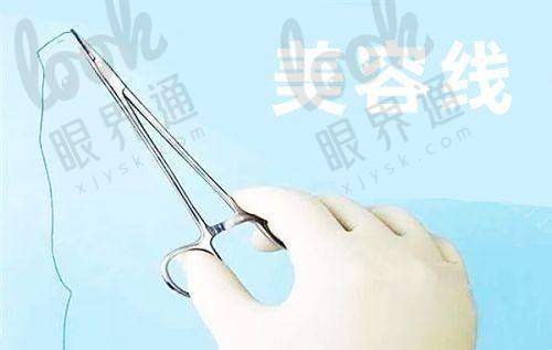 想知道上海郑小红修复双眼皮多少钱一次？直接看2025年收费价格表