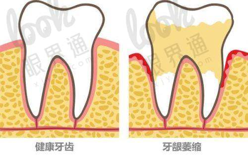 五、看牙体验:从“牙科恐惧症”到“躺平享受”