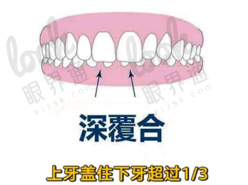 酒泉牙齿矫正哪里做的好？酒泉牙科医院哪家好？看这里让你轻松找到理想之选！