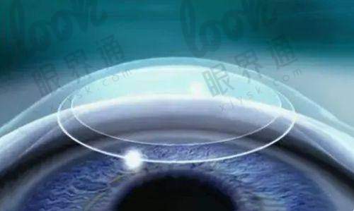 价格对比：谁的性价比更高？