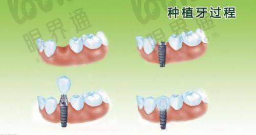 医院靠谱不靠谱？患者口碑才是“实锤”