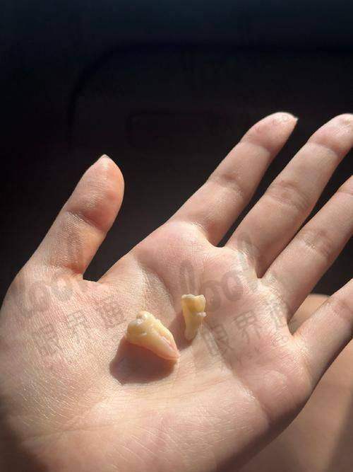 结语