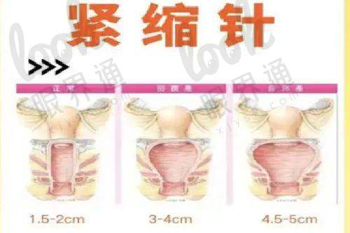 广东药科大学广州复星禅诚医院是私立还是公办？想要确定一下医院正规吗