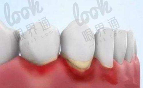 瑞士iti:高端品质,值得信赖