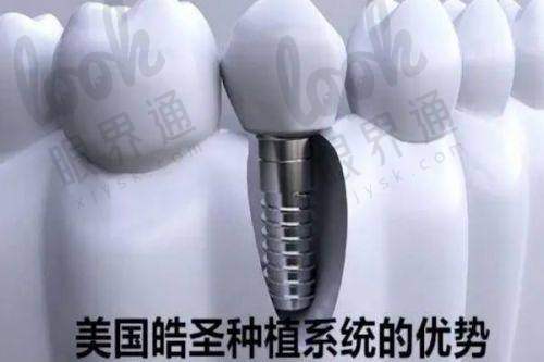 四、洗牙都能洗出