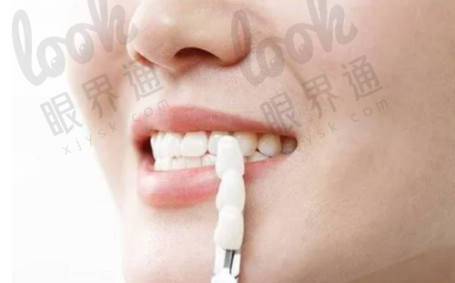 三、隐藏副本：这些附加项目可能让你超预算