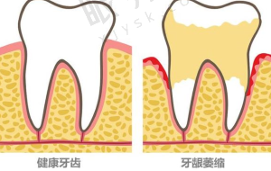 一、连锁品牌的"正规军"身份