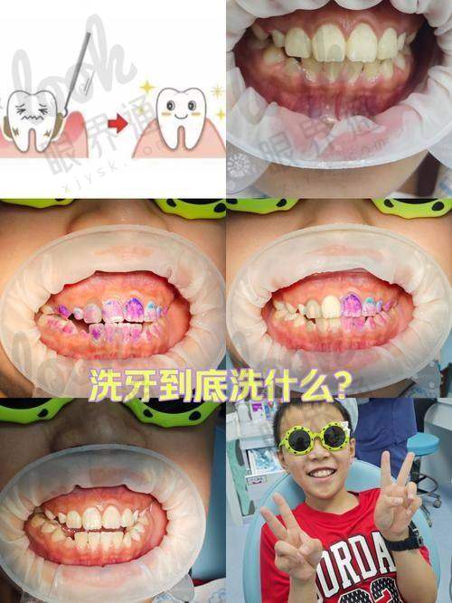 基础项目价格梳理