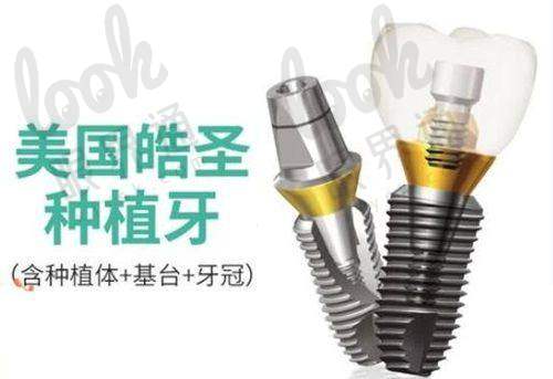 五、就诊指南：第一次种牙要注意这些