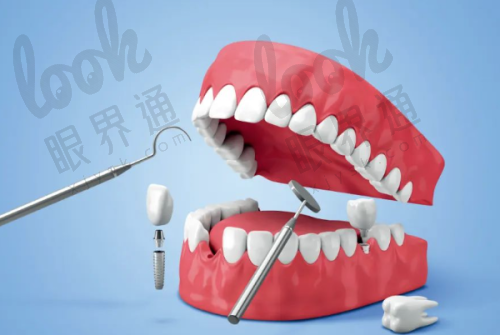 实体医院 VS 网传广告：西宁中诺种牙广告价可信吗？