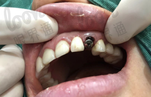 绍兴麦芽口腔收费价格表