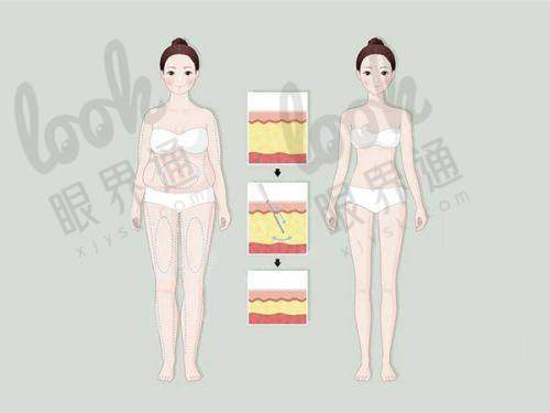 西安西美整形外科中 心怎么样？从技术到服务全方面剖析，答案在这里！