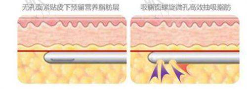 安心问题揭秘