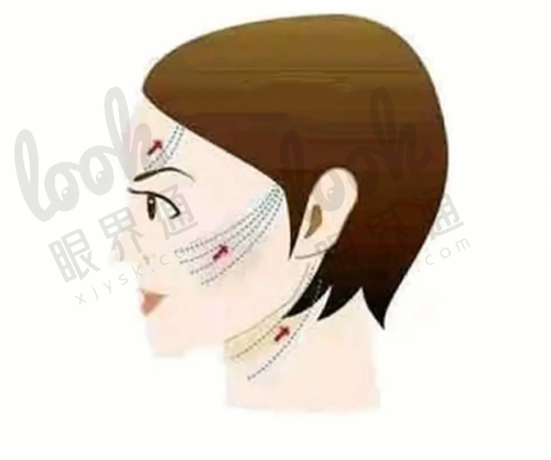 价格表摊开说：拒绝