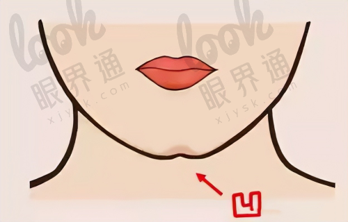 沈阳元辰医疗美容医院正规吗？是资质齐全的正规整形医院求美者评价高