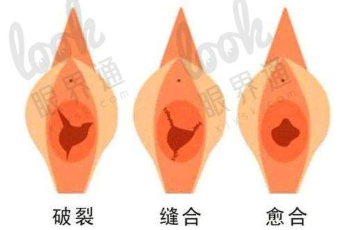 广州曙光医院价格公开透明，热门项目参考如下