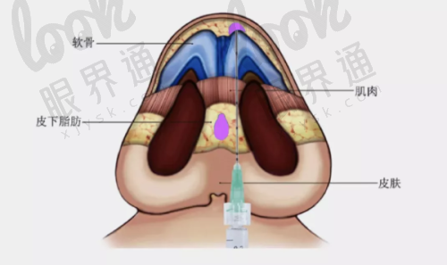 口碑与适用人群：谁更适合你？