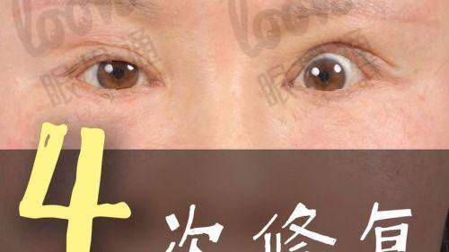成镇模 vs 同类型医生价格及技术对比
