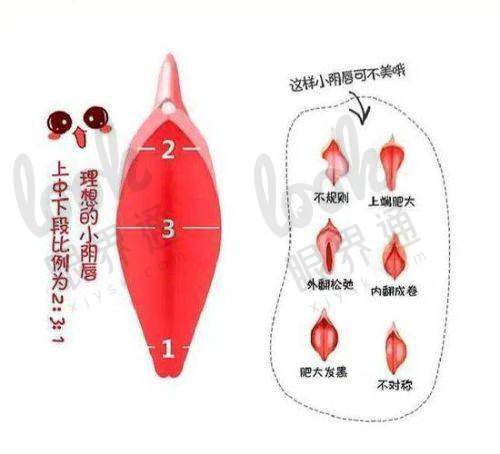 北京侯智慧医生技术优势详解：3D生物束带紧缩术