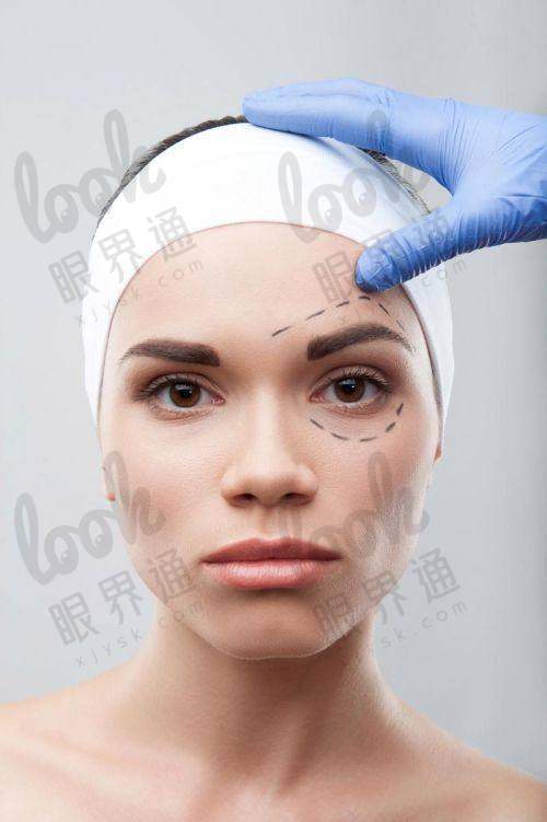 总结：北京袁强拉皮收费标准与实例的理想结合