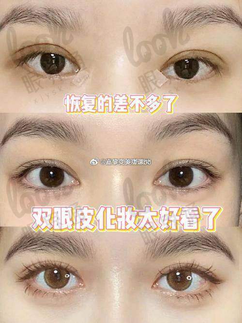 如何选择适合的修复方案