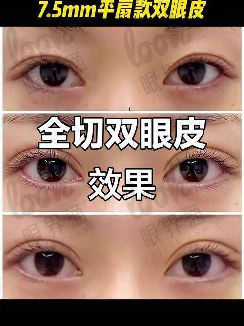 价格体系：透明合理，匹配修复难度