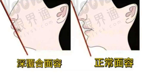一、种植牙价格大揭秘：从国产到进口，总有一款适合你