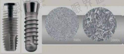 七、补牙材料：从
