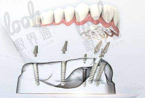 二、黑科技装备：让看牙变成科幻片