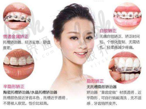 二、牙齿矫正：从