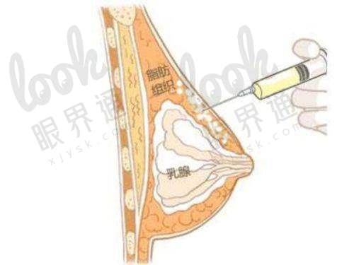 想了解西安西 京医院耳再造收费价格表？耳朵整形费用全知晓