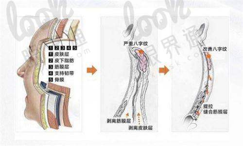 影响耳再造手术价格的因素