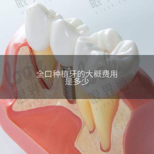 总结：种牙不贵，只要你选对地方和时间！