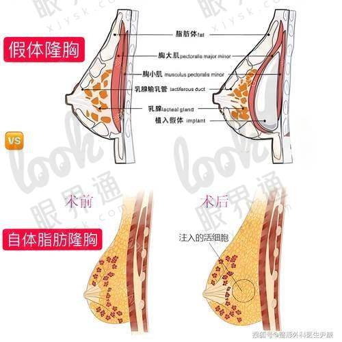 结语：八大处整形假体隆胸价格多少，不只是价的问题！