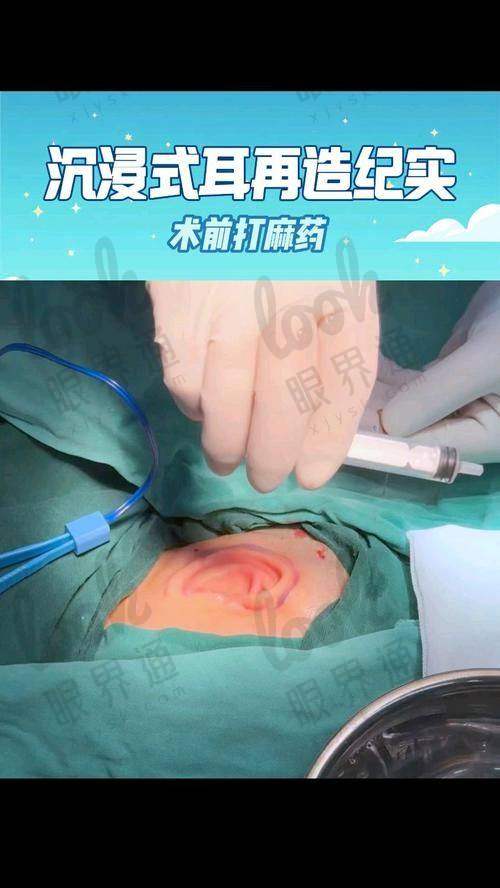 挂号攻略与省钱技巧