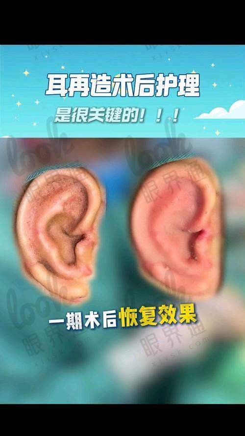 费用差异的三大核心因素