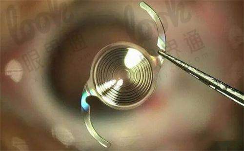 桂林爱尔眼科医院几路公交车可以到？营业时间+位置全攻略，轻松get明亮视界！