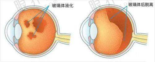 新视界眼科医院是私立还是公立？揭秘这家民营医院的收费贵不贵！