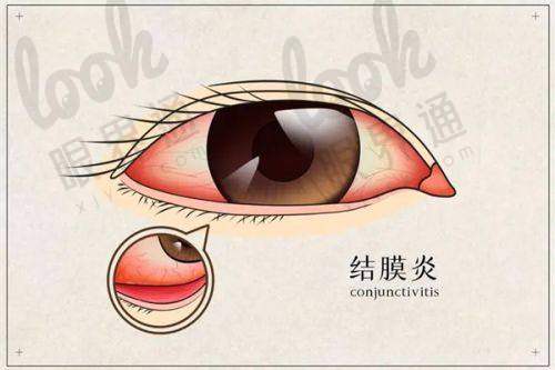 七、选择桂林爱尔眼科医院的N个理由