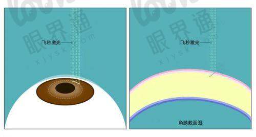 五、技术装备:眼科界的