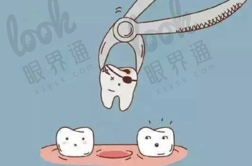 西安牙科拔智齿哪个便宜又好？美奥、诺贝尔、拜博等口腔都是不错之选