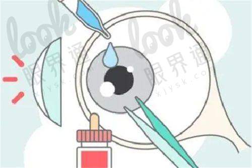总结