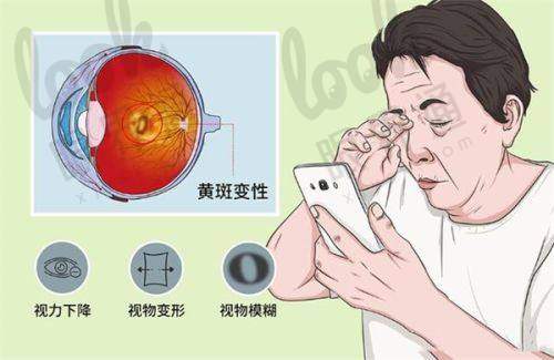【技术揭秘】从1800度近视到老花眼的