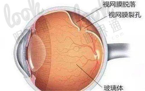 苏州光明眼科医院收费价目表2025出炉,全飞秒15800+半飞秒9800+ICL晶体植入30000+