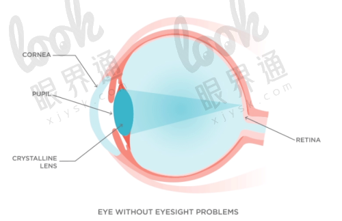 苏州光明眼科医院好不好？是正规的眼科医院擅长做近视眼矫正