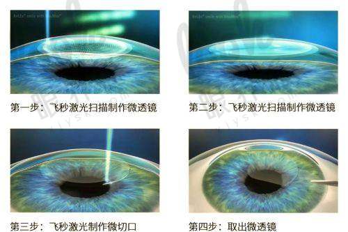 汕尾爱尔眼科医院靠不靠谱？政策、牌照咱们说清楚