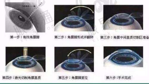 不仅仅有这一家？一城两院更灵活