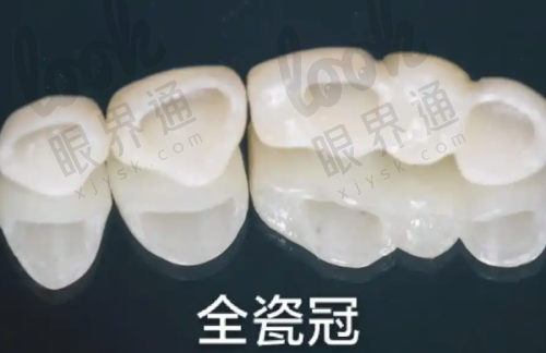 牙体牙髓